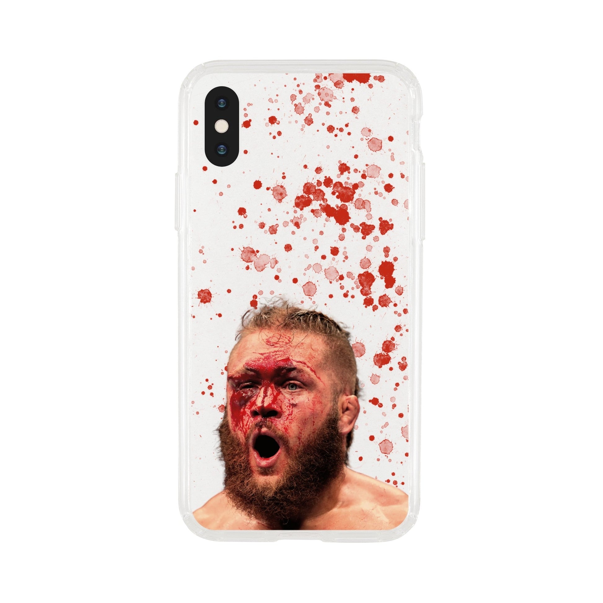 Rafael Fiziev Clear Phone Case - Raged MMA